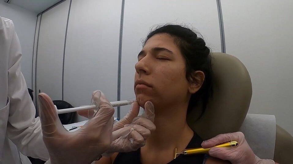 doctor numbing chin with anesthesia